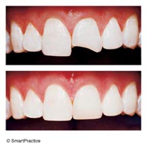 Smile Gallery - 	William J Briggs DDS APDC, San Diego Dentist