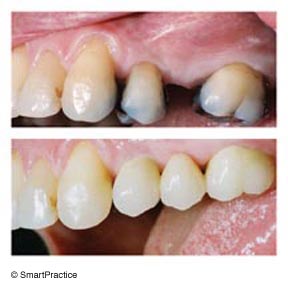 Smile Gallery - 	William J Briggs DDS APDC, San Diego Dentist