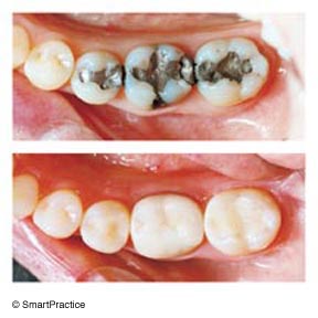 Smile Gallery - 	William J Briggs DDS APDC, San Diego Dentist