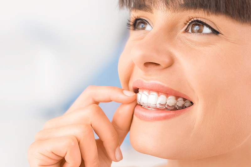 Invisalign in Aliso Viejo