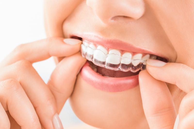 Quality Dental Treatments in Ellicott City