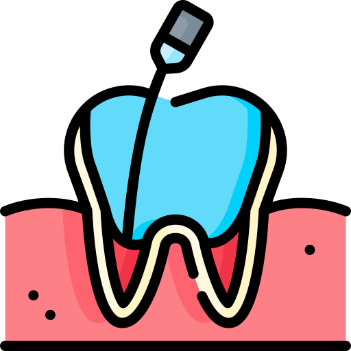 Root Canal in Arcadia