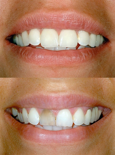 Cosmetic Dentistry in Chula Vista