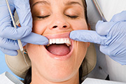 Dental Crowns in Alhambra