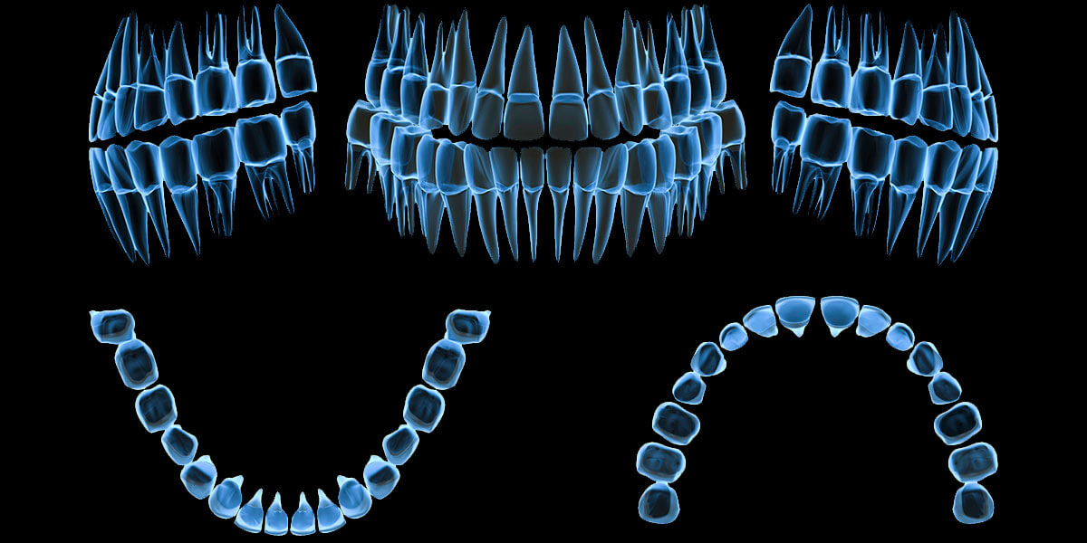 Computerized Digital Radiography - The Center for High Tech Dentistry, New York Dentist