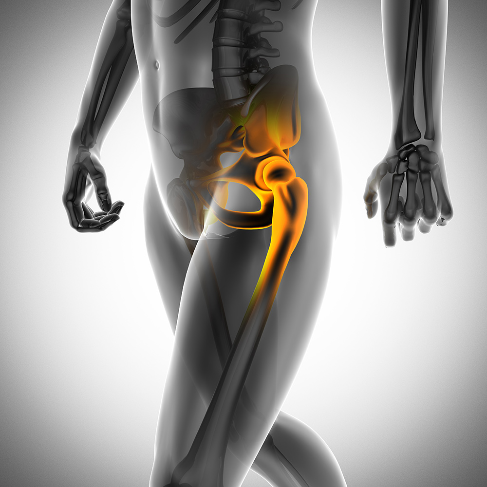 Hip Pain in Burbank