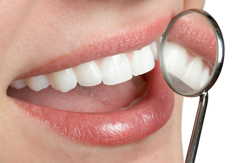 Happy Tooth Dental Dental Offer