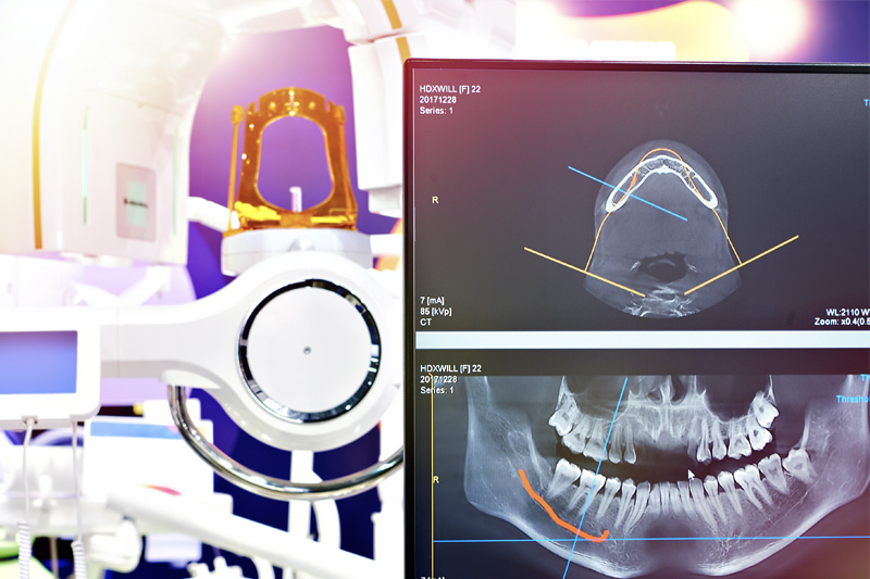 Cone Beam CT Imaging in 