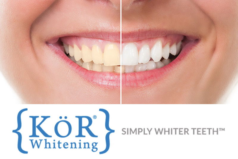 Teeth Whitening in Philadelphia