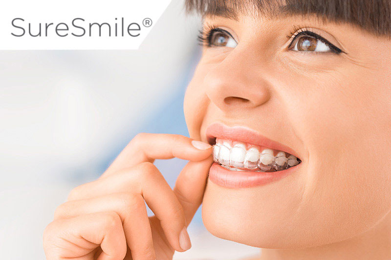 Sure Smiles Clear Aligners in Sherman