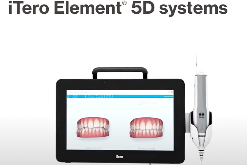 Digital X-Rays in 