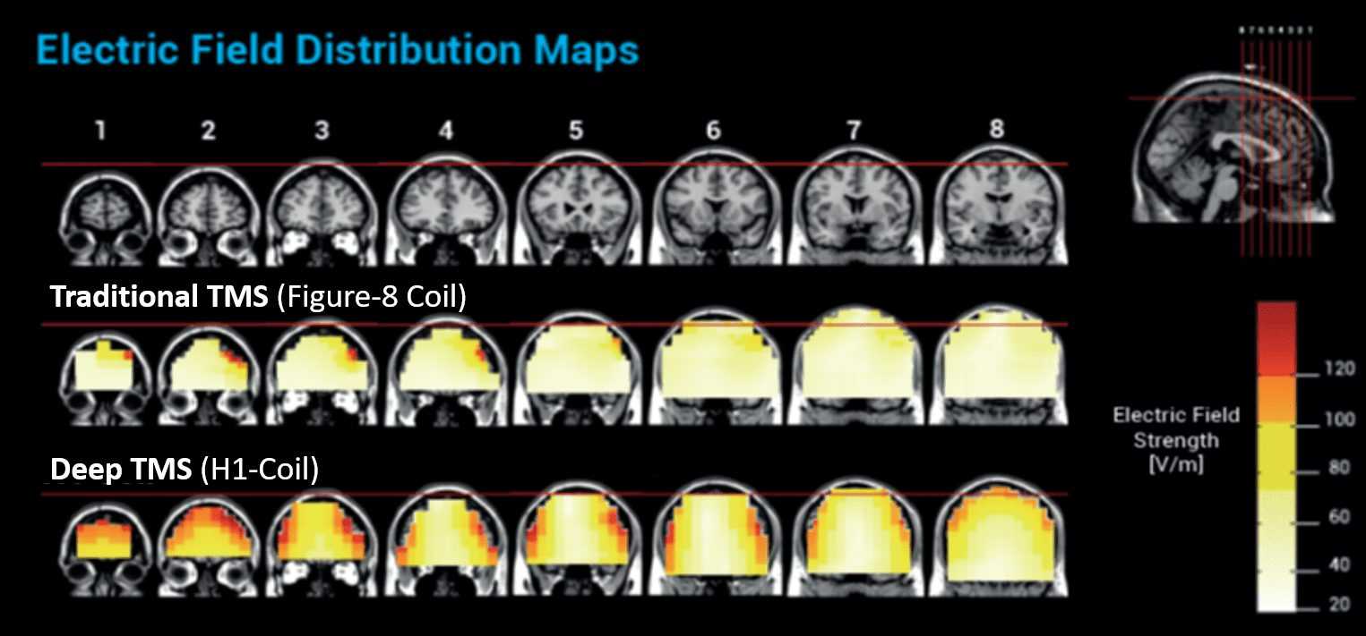 Deep TMS electric field distribution maps