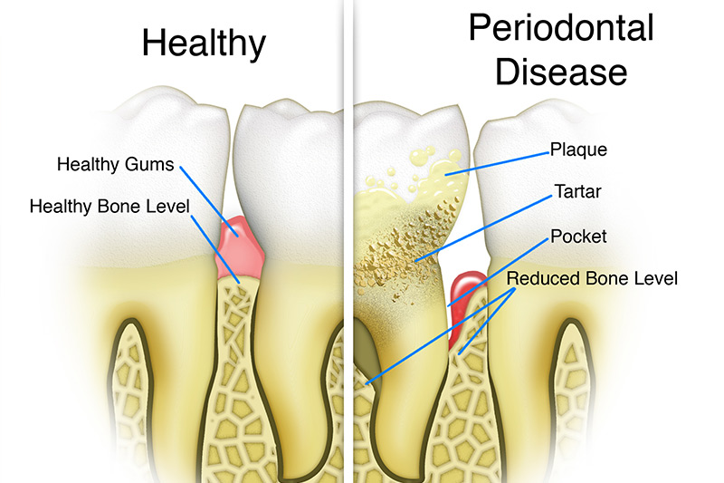 Periodontics in Berwyn