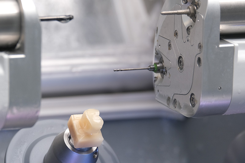 3D Printed Restorations in 